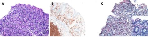 Photomicrographs Of A Colonic Specimen From A Healthy Donor Download Scientific Diagram