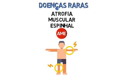 Atrofia Muscular Espinhal Ame Que Saber Mais Vem Aqui Youtube