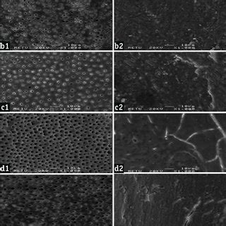 Representative Scanning Electron Microscope Micrographs 1000 Showing