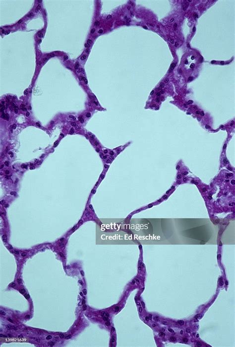 Alveoli Alveolar Sacs Normal Lung Tissue 100x At 35mm Shows Alveoli And