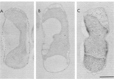 Immunoelectron Microscopic Localization Of The Ompa A Protein A