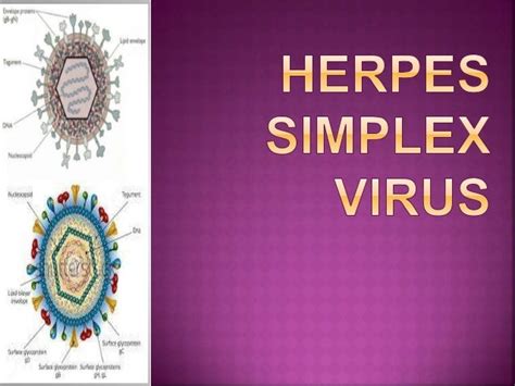 Herpes Simplex Virus