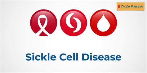 Sickle Cell Crisis Symptoms Causes And Prevention Dr Lal Pathlabs Blogs