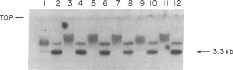 Methylation Of C C G G Sites Surrounding The J34 Globin Gene In