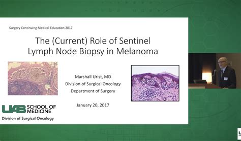 The Current Role Of Sentinel Lymph Node Biopsy In Melanoma