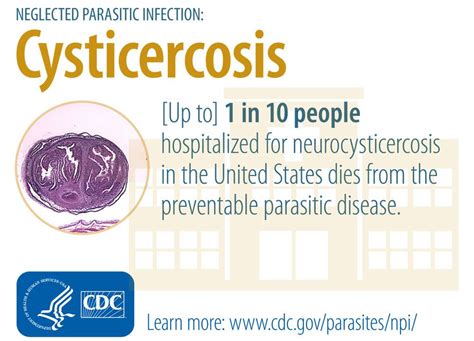 Cdc Cysticercosis General Information Faqs Infographic Health