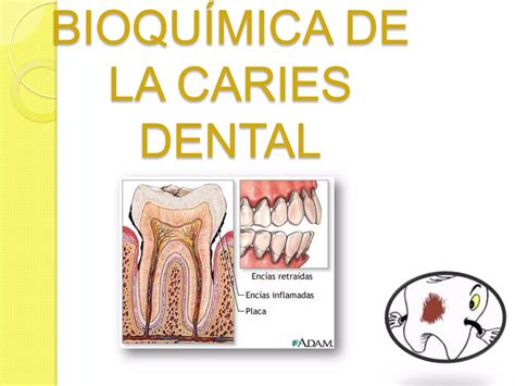 Teorías Explican Mecanismos Caries Dental Ppt