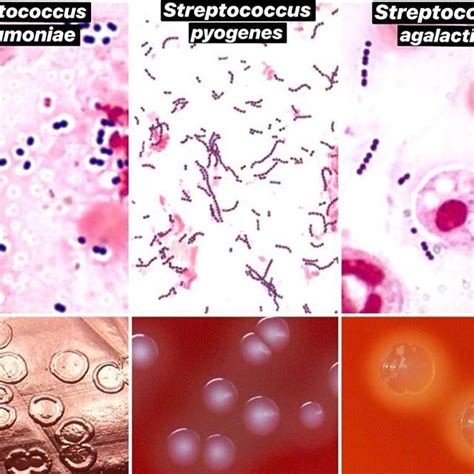 1. Streptococcus pneumoniae 2. Streptococcus pyogenes 3. Streptococcus agalactiae Gram stain ...