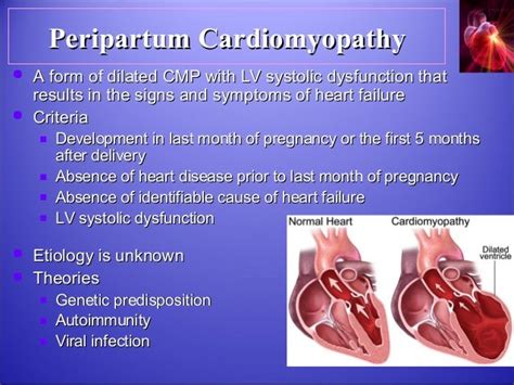 Cardiac Disease In Pregnancy