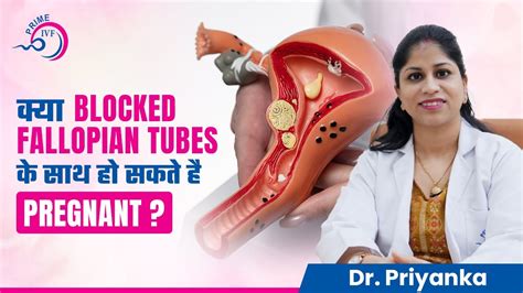 Fallopian Tubes में रुकावट के बाद Pregnant कैसे हों Fallopian Tubes