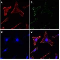 Actin Cytoskeleton Focal Adhesion Staining Kit Fak