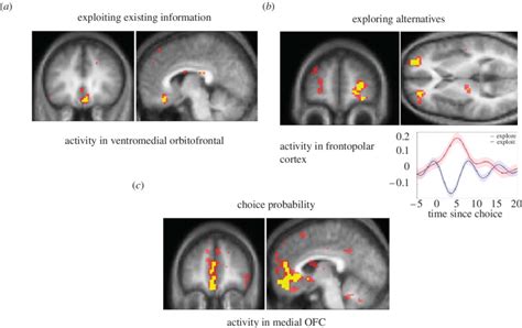 A Regions Of Ventromedial Prefrontal Cortex Where Activity Increases