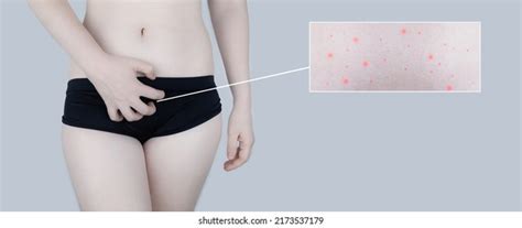 3 314 Bikini Area Images Stock Photos Vectors Shutterstock
