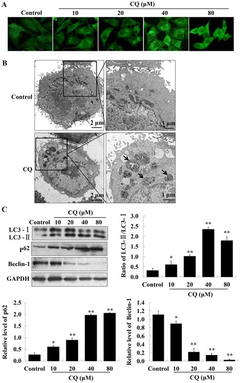 Chloroquine Inhibits Cell Growth In Human A549 Lung Cancer Cells By