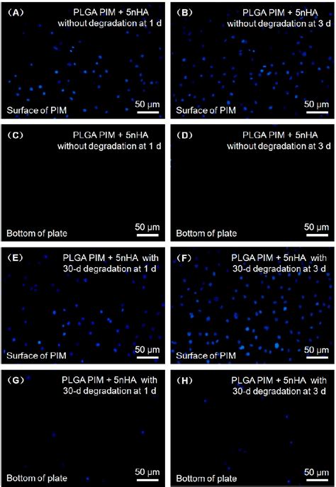 Figure 2 From Bilayer Poly Lactic Co Glycolic Acid Nano Hydroxyapatite