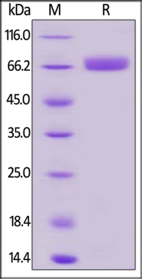 ACROBiosystems ACROBiosystems Biotinylated Human CD200 OX 2 Protein