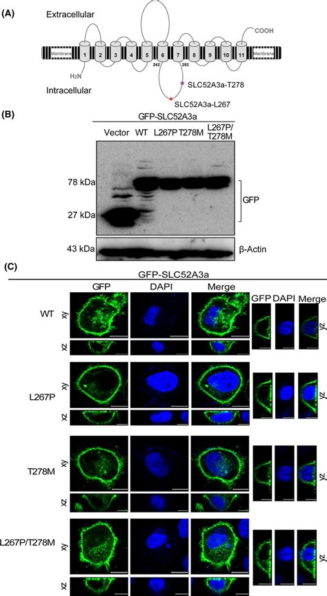 Subcellular Localization Of Gfp Tagged Slc52a3a In Escc Cell Lines By