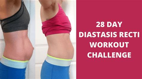 Free 28 Day Diastasis Recti Workout Challenge Youtube