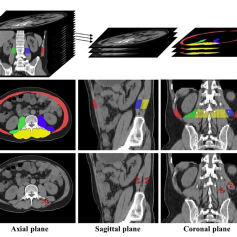 A The Axial CT Slices Related To L3 Are Labeled And Extracted B