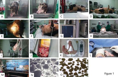 Pig To Nonhuman Primate Nhp Naked Islet Xenotransplantation Intechopen