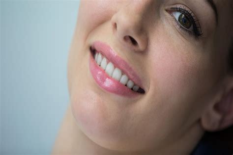 Teeth Whitening Newcastle How To Achieve Results Without Damaging