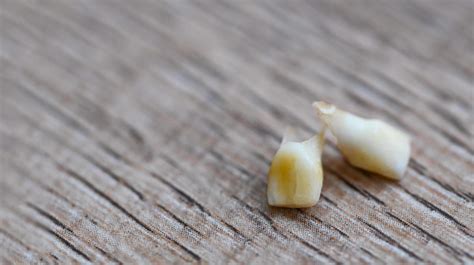 Milk tooth , Close up baby teeth of tooth loss on wooden , milk tooth ...