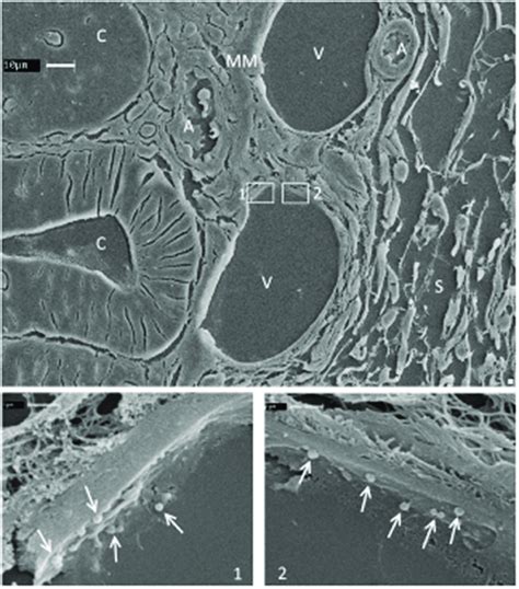 Representative Sem Image Of Semi Thin Sections Of Colon Specimen Download Scientific Diagram