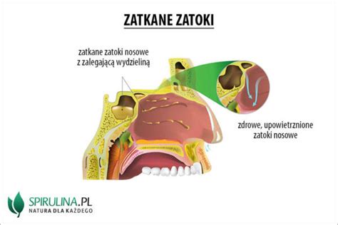 Zatkane Zatoki Algi Spirulina I Chlorella