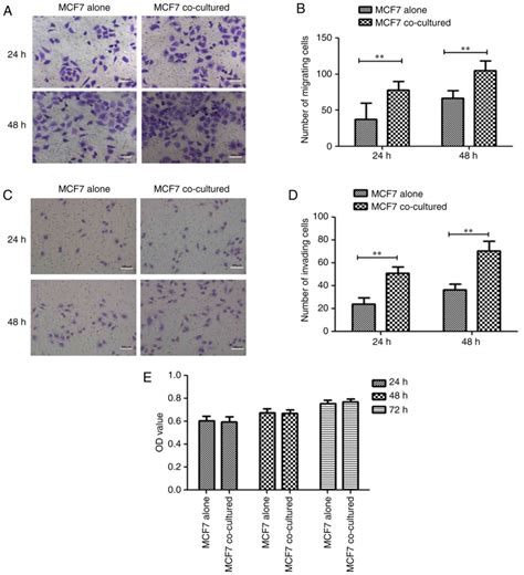 Human Adipose‑derived Mesenchymal Stem Cells Promote Breast Cancer Mcf7