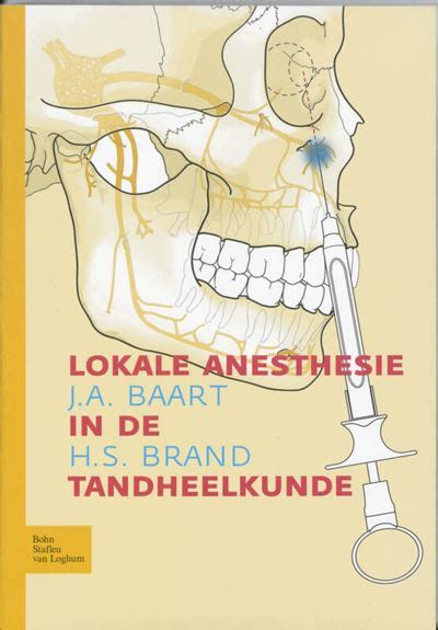 Lokale anesthesie in de tandheelkunde broché Achat Livre fnac