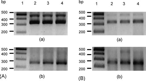 Agarose Gel Electrophoresis Of Rt Pcr Products Resulting From The