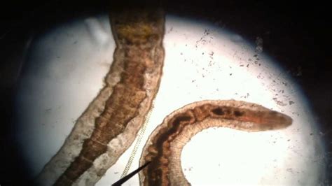 Biology Cool Microscopic Pond Water Organisms Oligiochaete Worm Youtube