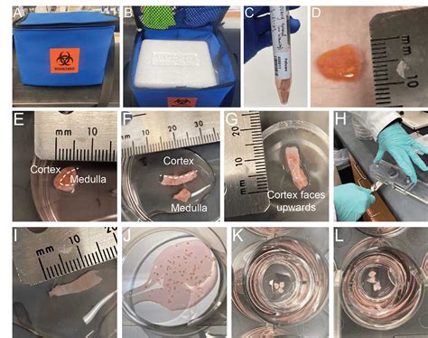 Human Ovarian Tissue Explant Cultures Static Or Fluidic Conditions