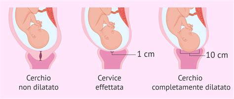 Cambiamenti E Posizione Della Cervice Durante La Gravidanza