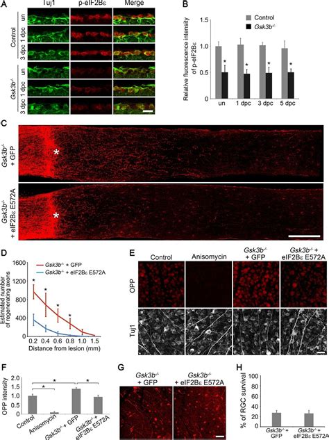 Figures And Data In Gsk Regulates Akt Induced Central Nervous System