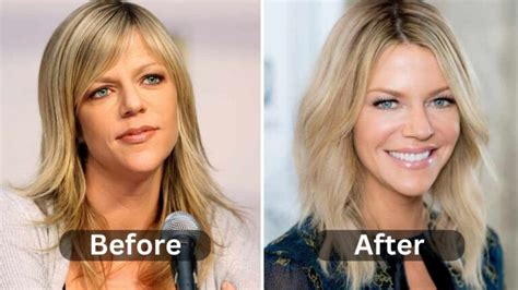 Plastic Surgery Archives Weight Loss