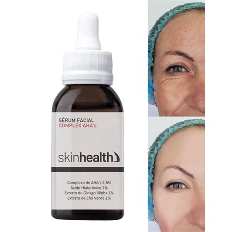 S Rum Clareador Para Melasma E Manchas Escuras Complex Ahas No Shoptime