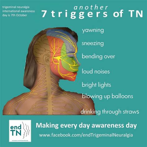 Trigeminal Neuralgia