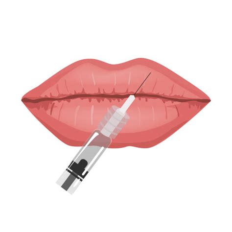 Efudex Treatment Pictures Lips Clipart