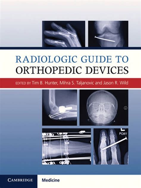 Radiologic Guide To Orthopedic Devices Vasiliadis Medical Books