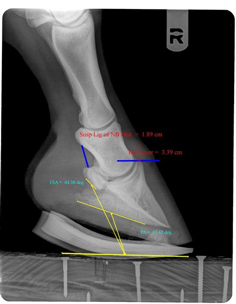 Innovative Equine Podiatry: Navicular case examples