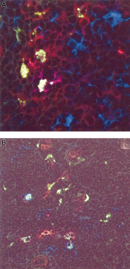 Development Of Immature And Mature DCs After Intrathymic Injection Of