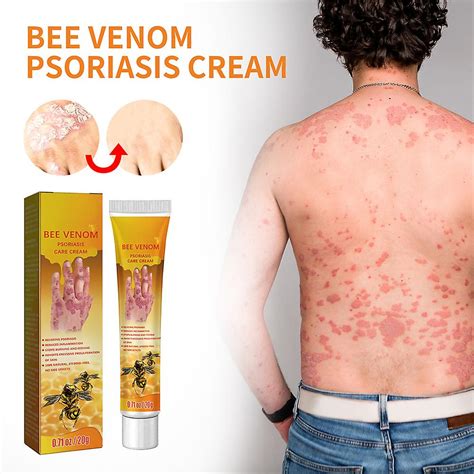 New Bee Venom Treatment Cream 20g Fruugo UK