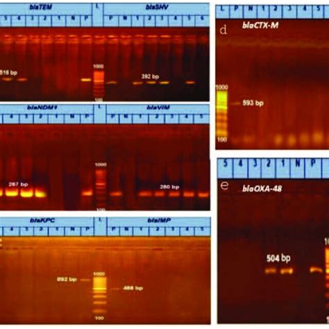 Representative Electrophoresis Of Metallo B Lactamases Mbl And