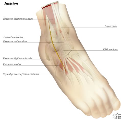 Lateral Malleolus Anatomy