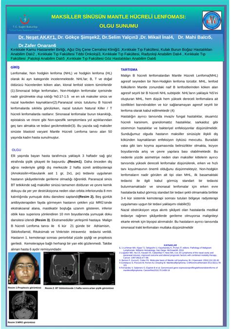 Pdf Rp Maksillersin Ste Mantle H Crelilenfoma Olgu Sunumu