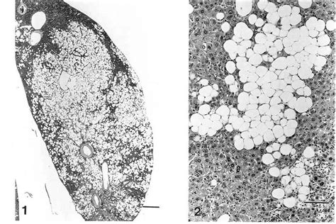 Liver Lipomatous Lesion In A B6c3f1 Mouse Note That The Download Scientific Diagram