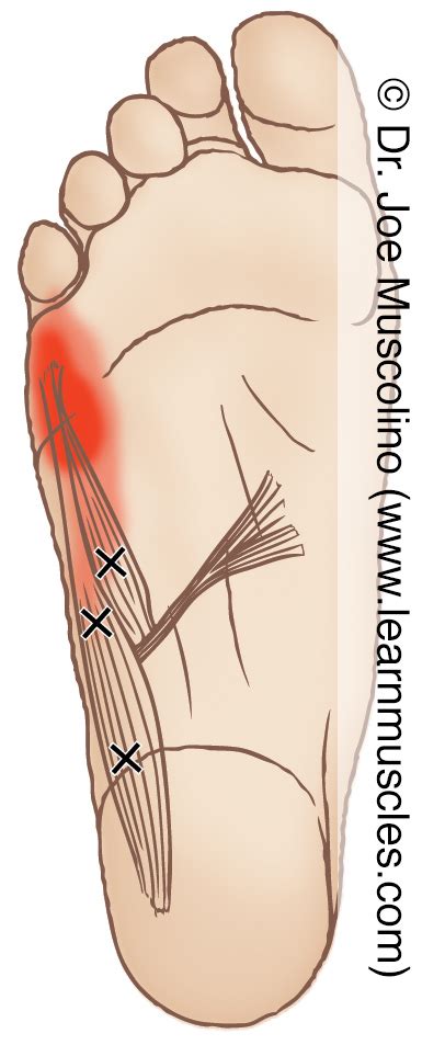 Abductor Digiti Minimi Foot Pain