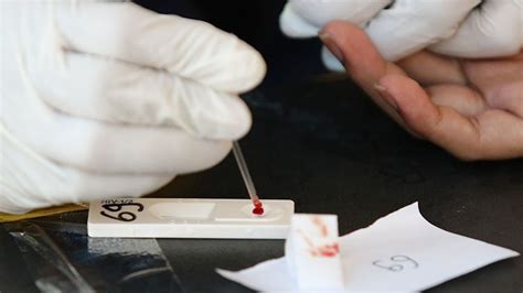 Pria Pesta Gay Di Puncak Bogor Dinkes Temukan Ada Yang Reaktif Hiv