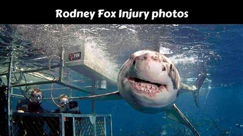 Rodney Fox Injury Photos